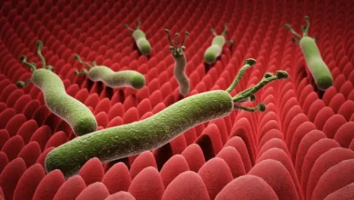 جرثومة المعدة