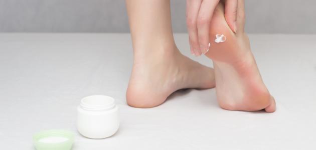 علاج تشققات القدمين